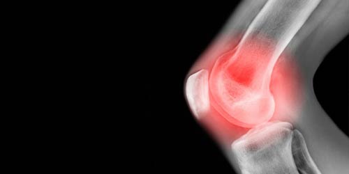 knee rezaaskari - آسيب هاي زانو در کوهنوردی - Knee injuries